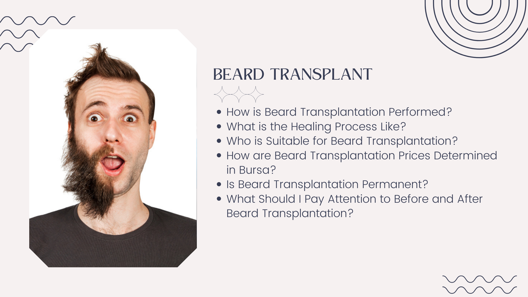 Beard Transplant